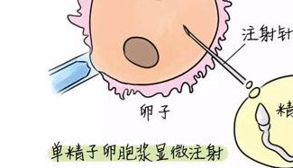 174医院做二代试管的流程是什么？做二代试管婴儿有哪些注意事项