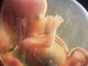 2026年上海国妇婴第三代试管婴儿费用解读及案例深度剖析