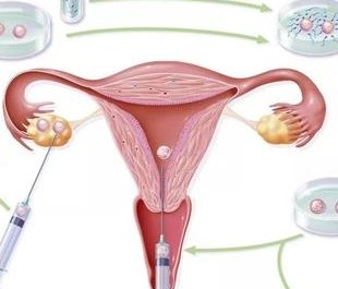 2026三亚三代试管私立医院在哪里？三亚比较好的试管医院